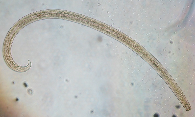 Nematode larvae